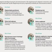 DEXIS OP 3D EX 10×11 – tomograf stomatologiczny 3D