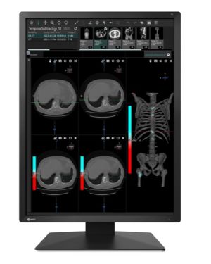 Eizo MX217- monitor medyczny, stomatologiczny