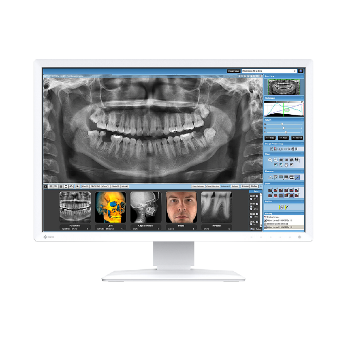 Eizo MX243W- monitor medyczny, stomatologiczny BIAŁY